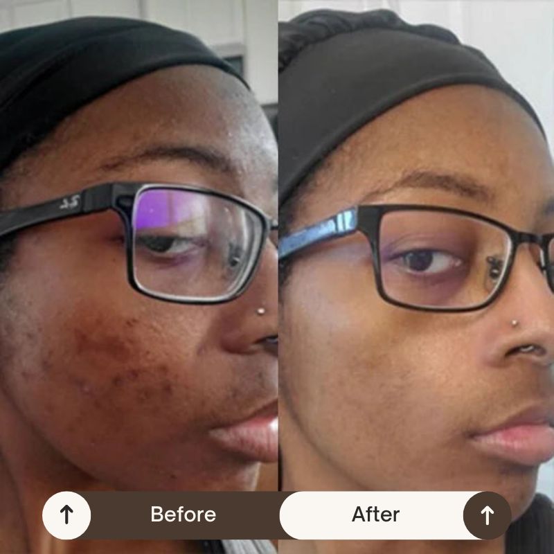 VeluraSkin™ - NightCare Anti-Imperfection Collagen Face Mask (75mL) + FREE Brush