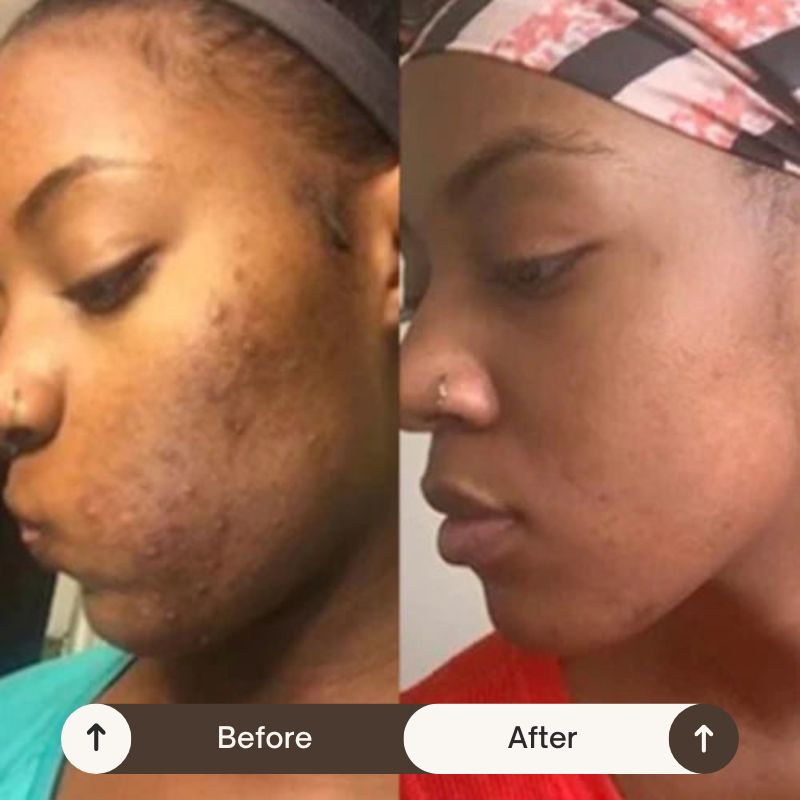 VeluraSkin™ - NightCare Anti-Imperfection Collagen Face Mask (75mL) + FREE Brush