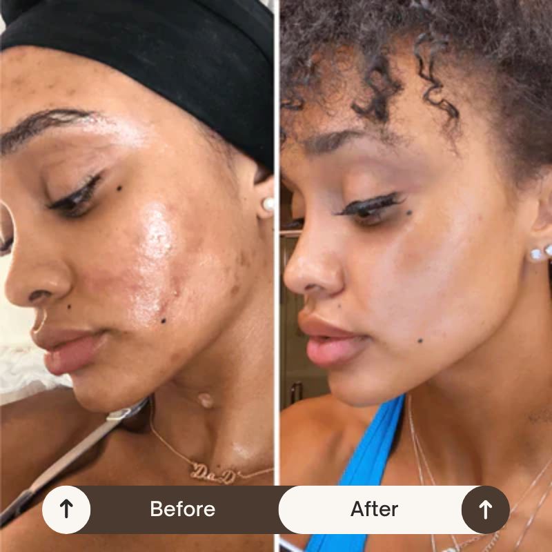 VeluraSkin™ - NightCare Anti-Imperfection Collagen Face Mask (75mL) + FREE Brush