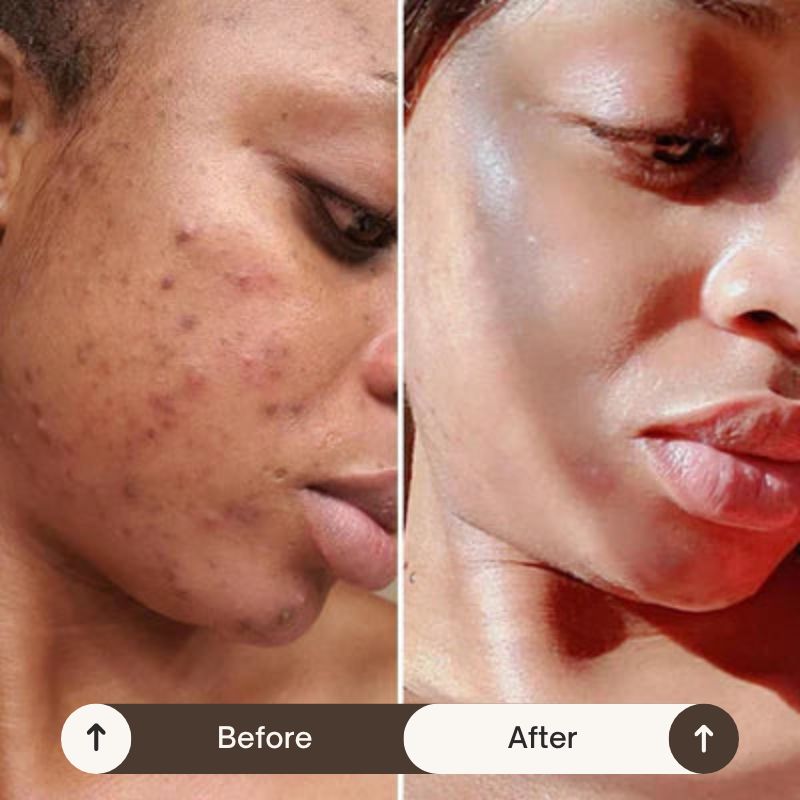 VeluraSkin™ - NightCare Anti-Imperfection Collagen Face Mask (75mL) + FREE Brush
