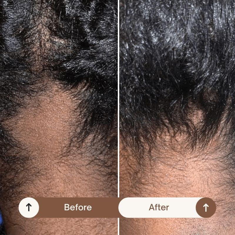 Veganic™ - Natural Hair Growth Oil (60mL)